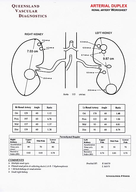 Renal Artery Duplex - Queensland Vascular Diognostics