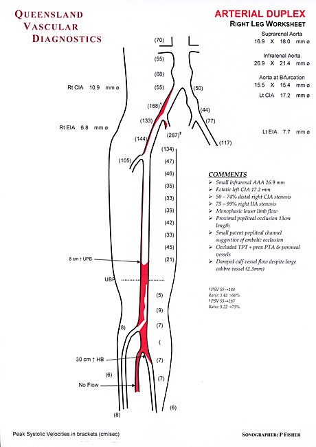 Lower Extremity Arteries - Queensland Vascular Diognostics